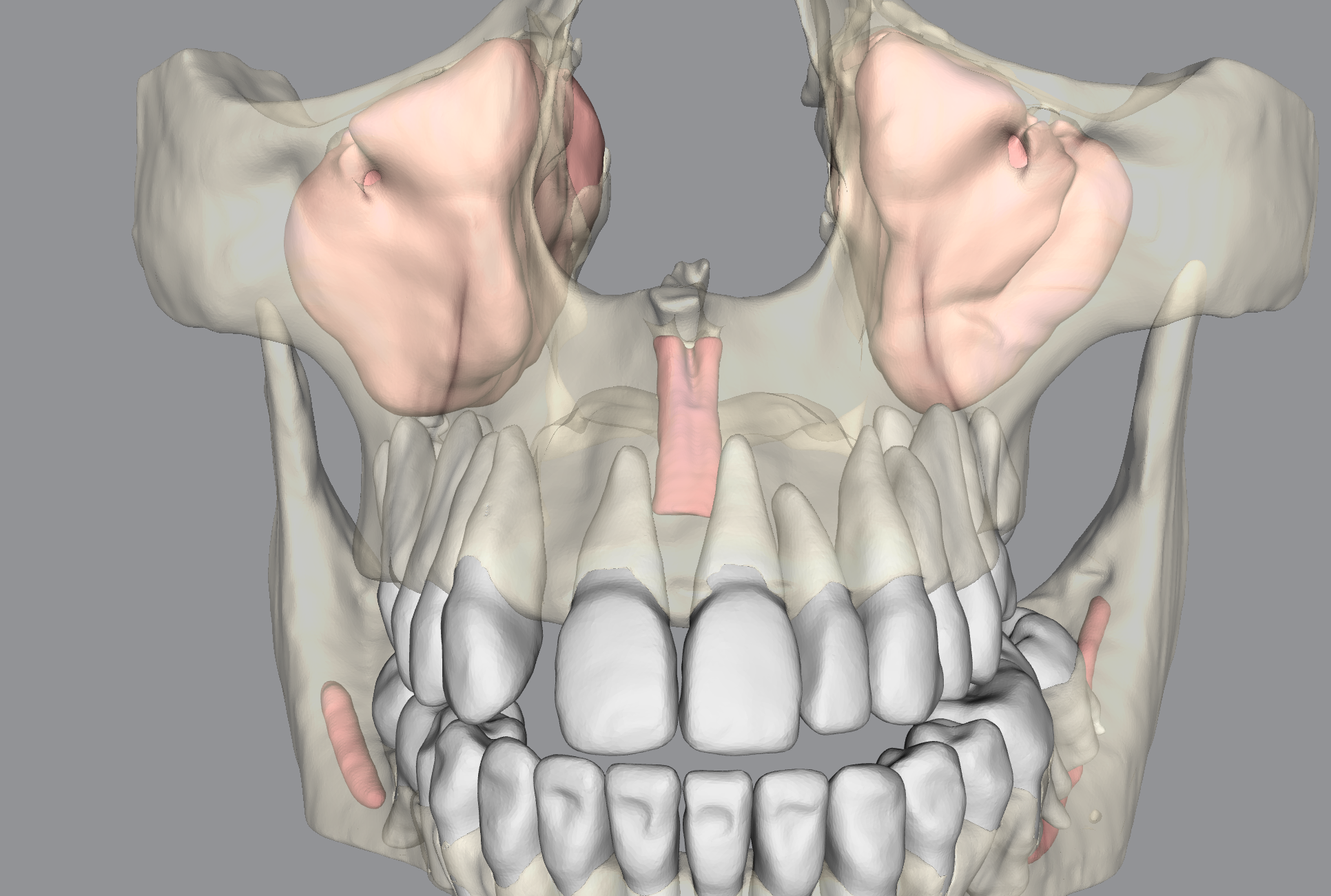 CBCT Segmentation